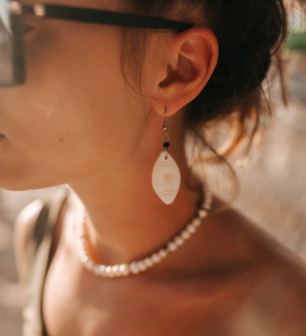 Carlos-Colette-Otoplastia