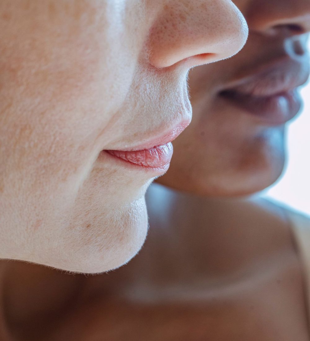 Carlos-Colette-rinoplastia